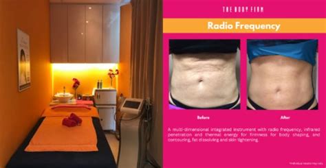 Body Sculpting Singapore .